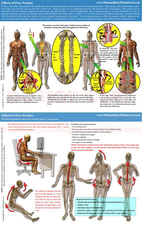 Effects of Poor Posture