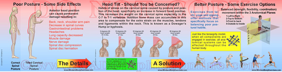 Poor Posture & methods to Counterbalance-slide show